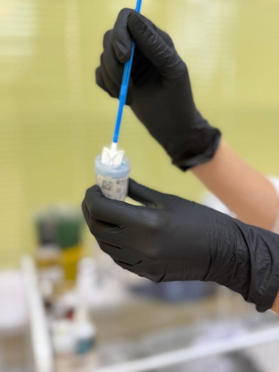 Забор анализов у гинеколога в Краснодаре